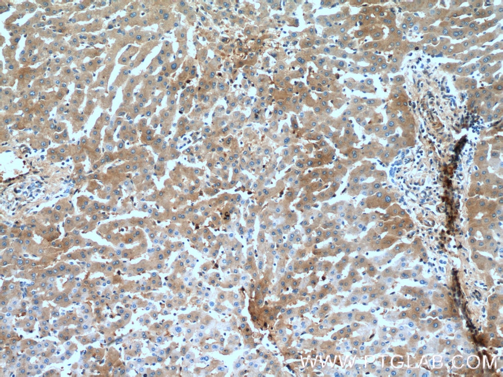 Immunohistochemistry (IHC) staining of human liver tissue using Alpha 1 Antitrypsin Monoclonal antibody (66135-1-Ig)