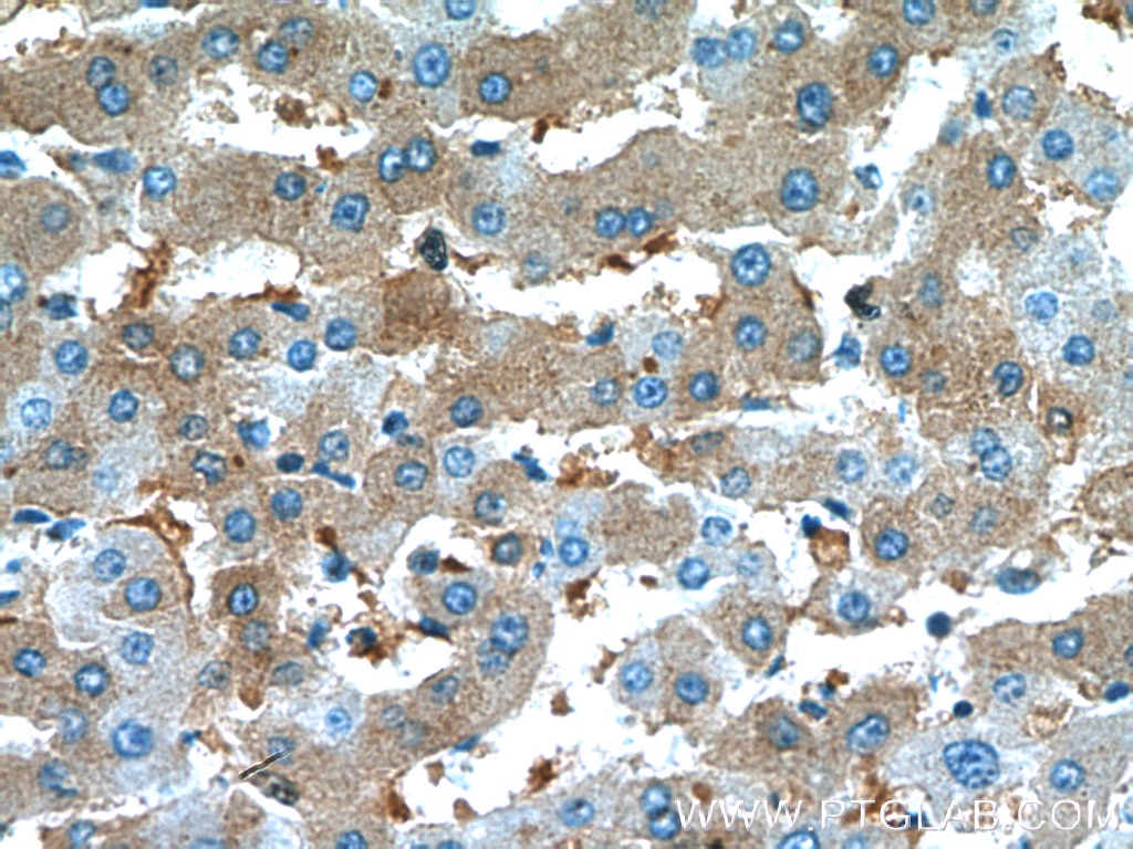 Immunohistochemistry (IHC) staining of human liver tissue using Alpha 1 Antitrypsin Monoclonal antibody (66135-1-Ig)