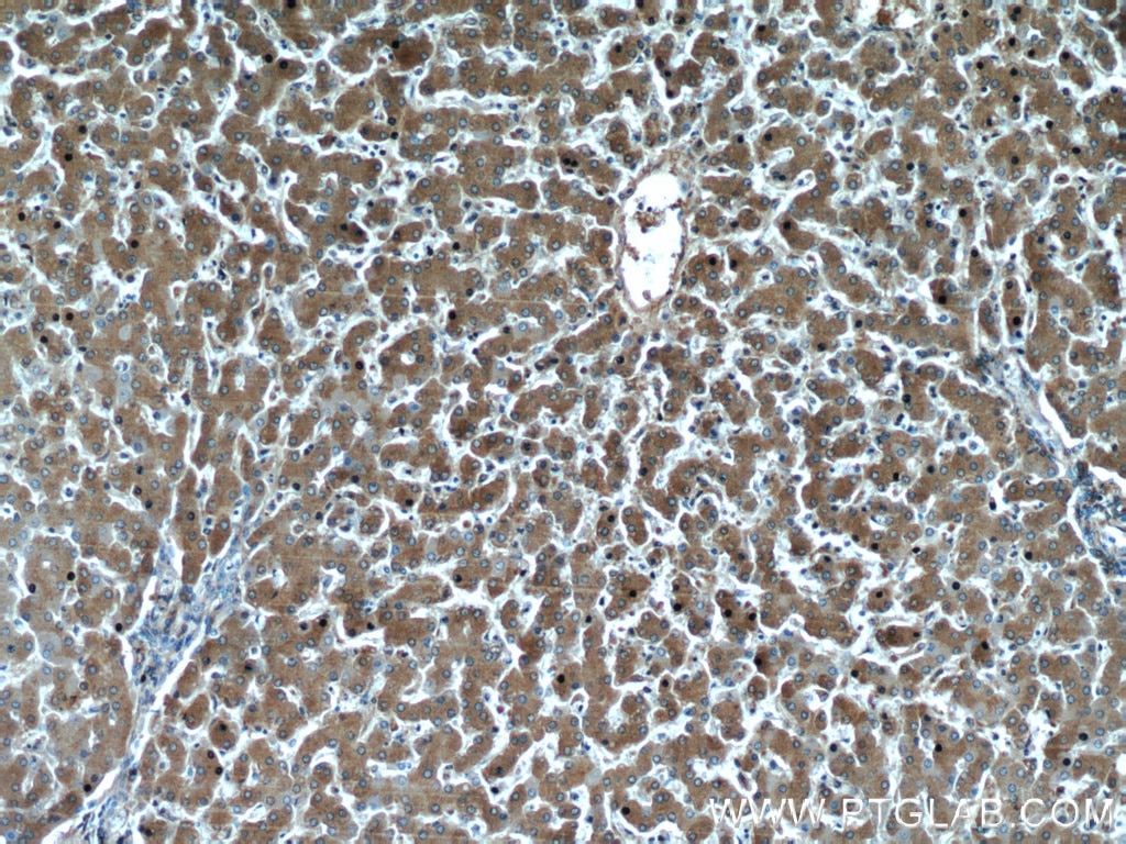 Immunohistochemistry (IHC) staining of human liver tissue using Alpha 1 Antitrypsin Monoclonal antibody (66135-1-Ig)