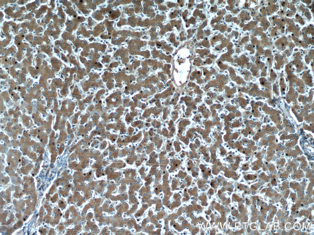 IHC staining of human liver using 66135-1-Ig