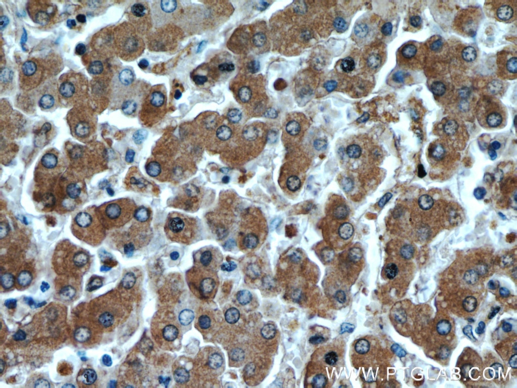 Immunohistochemistry (IHC) staining of human liver tissue using Alpha 1 Antitrypsin Monoclonal antibody (66135-1-Ig)