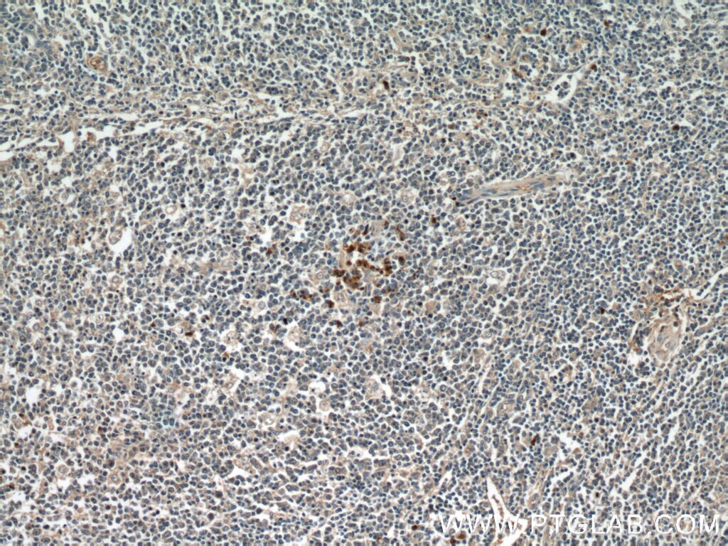 Alpha 1 Antitrypsin