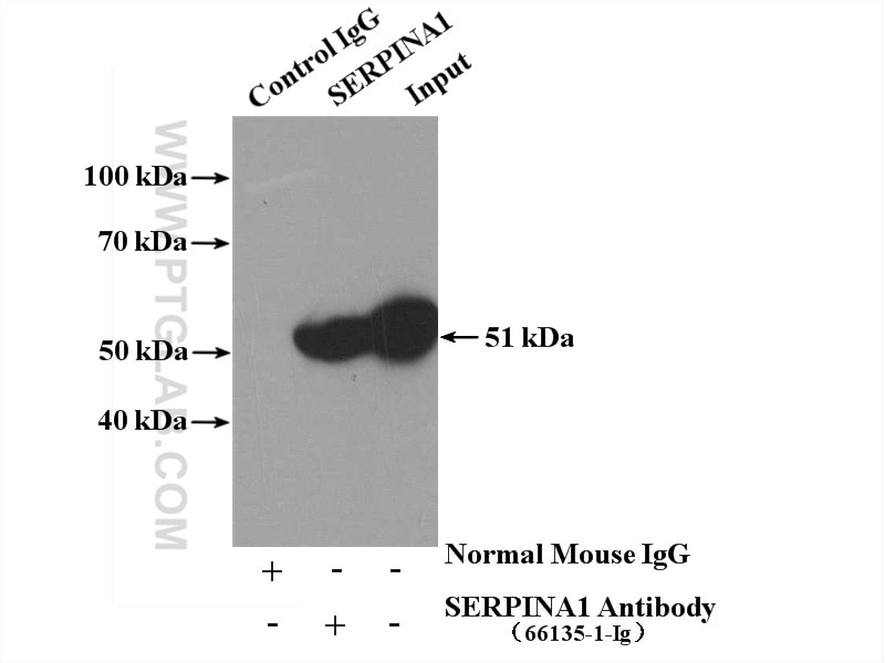 Immunoprecipitation (IP) experiment of human plasma using Alpha 1 Antitrypsin Monoclonal antibody (66135-1-Ig)