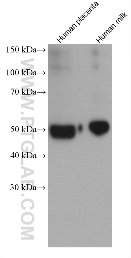 Western Blot (WB) analysis of various lysates using Alpha 1 Antitrypsin Monoclonal antibody (66135-1-Ig)