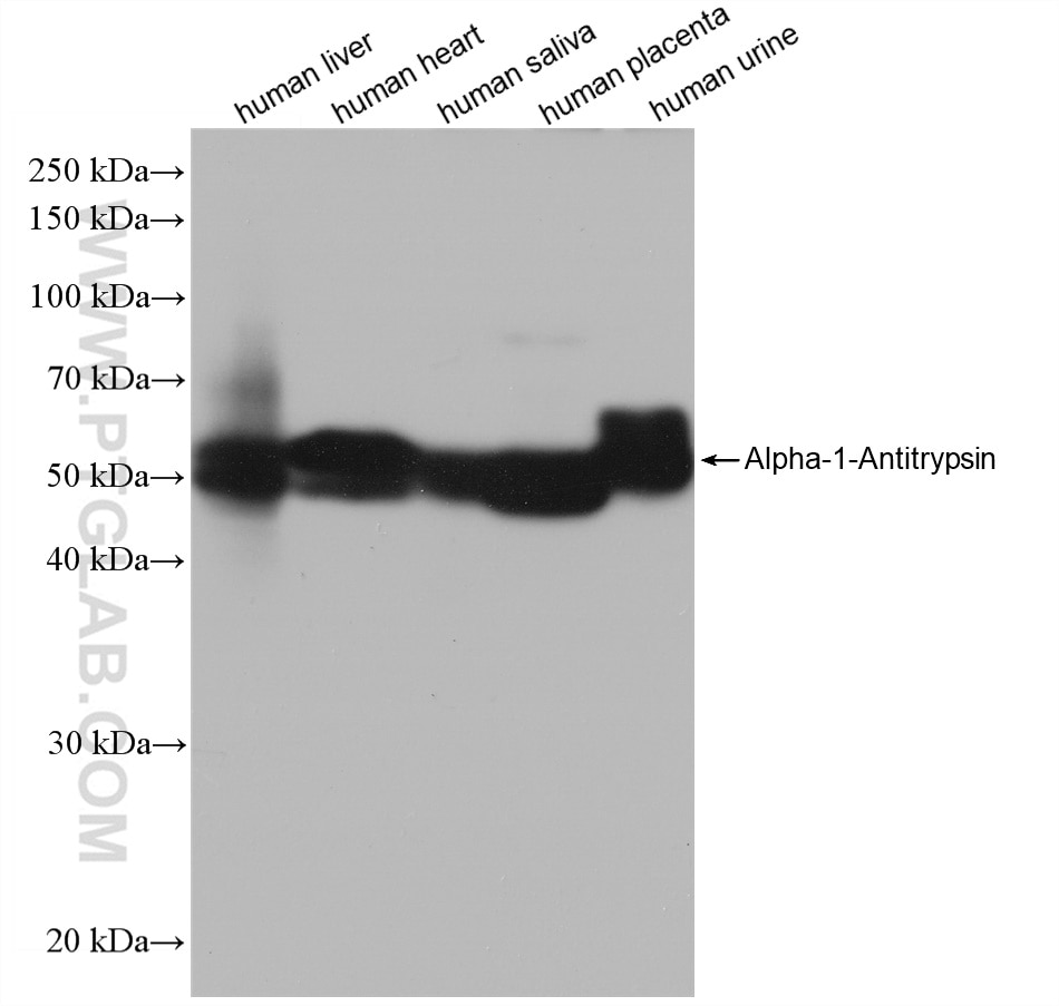 Western Blot (WB) analysis of various lysates using Alpha-1-Antitrypsin Recombinant antibody (82918-1-RR)