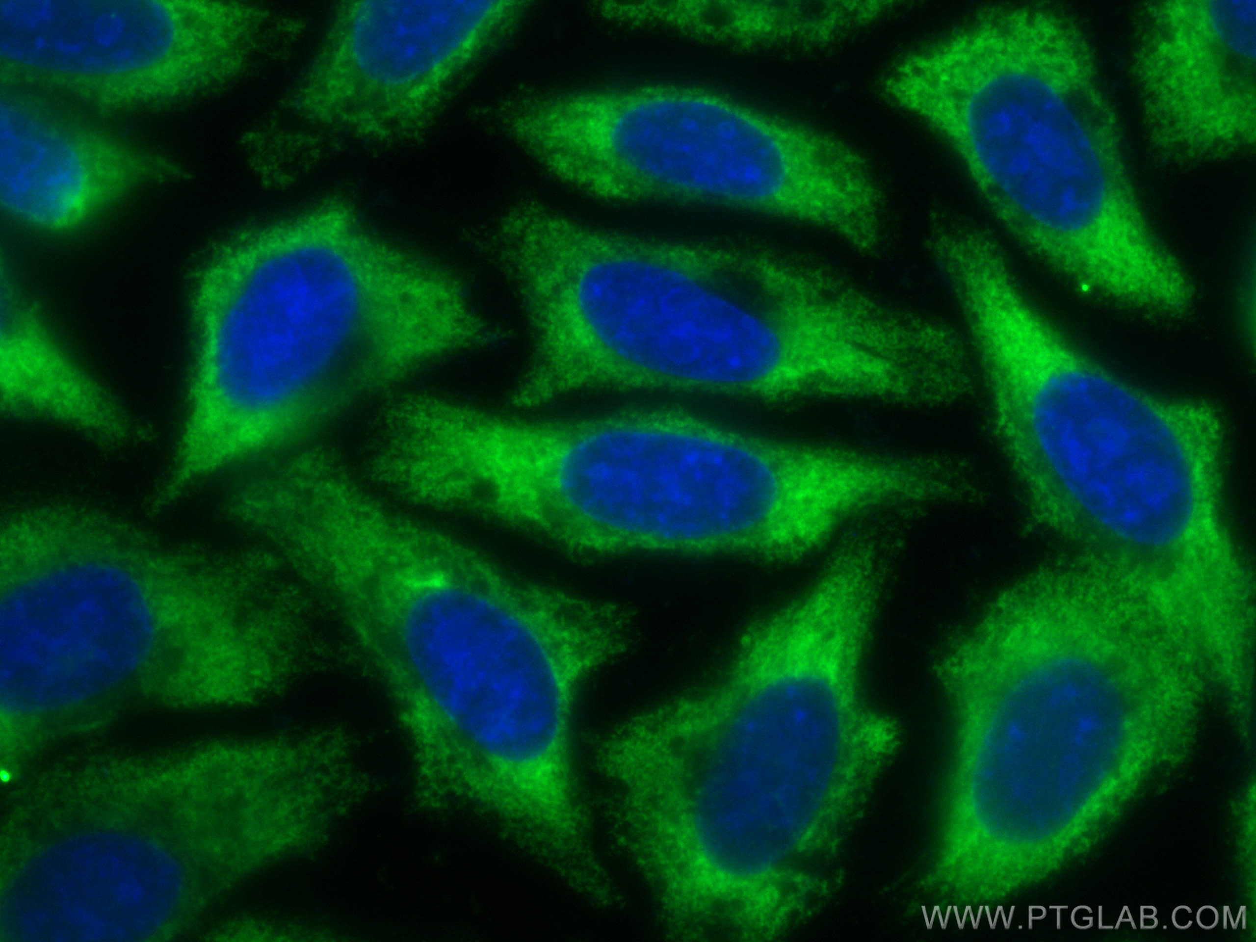 IF Staining of HepG2 using CL488-66135