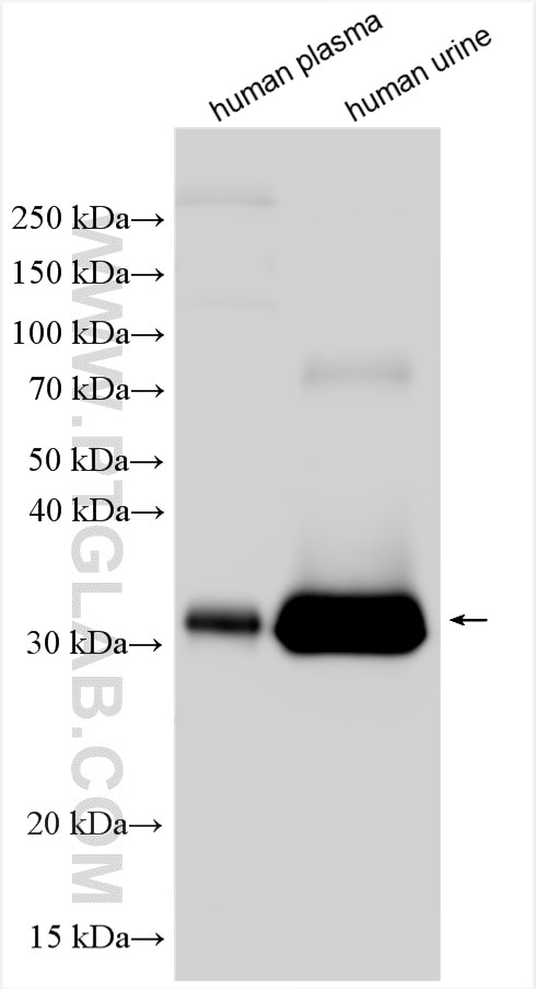 Western Blot (WB) analysis of various lysates using Alpha 1 microglobulin Polyclonal antibody (26716-1-AP)