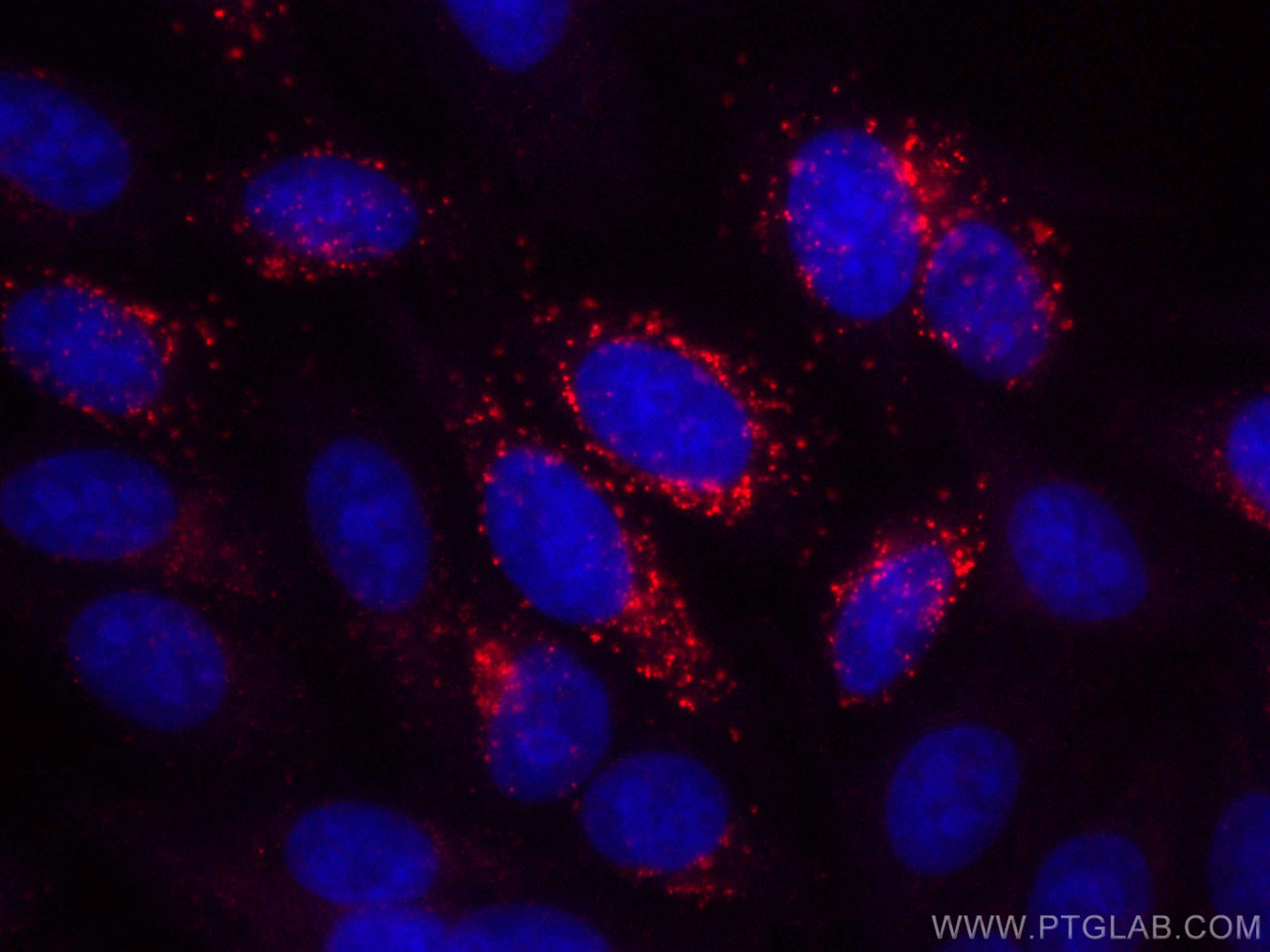 Immunofluorescence (IF) / fluorescent staining of HepG2 cells using CoraLite®594-conjugated Alpha 1B-Glycoprotein Mono (CL594-66260)