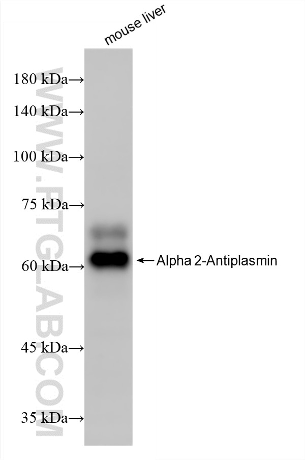 Western Blot (WB) analysis of mouse liver tissue using Alpha 2-Antiplasmin Recombinant antibody (86042-3-RR)