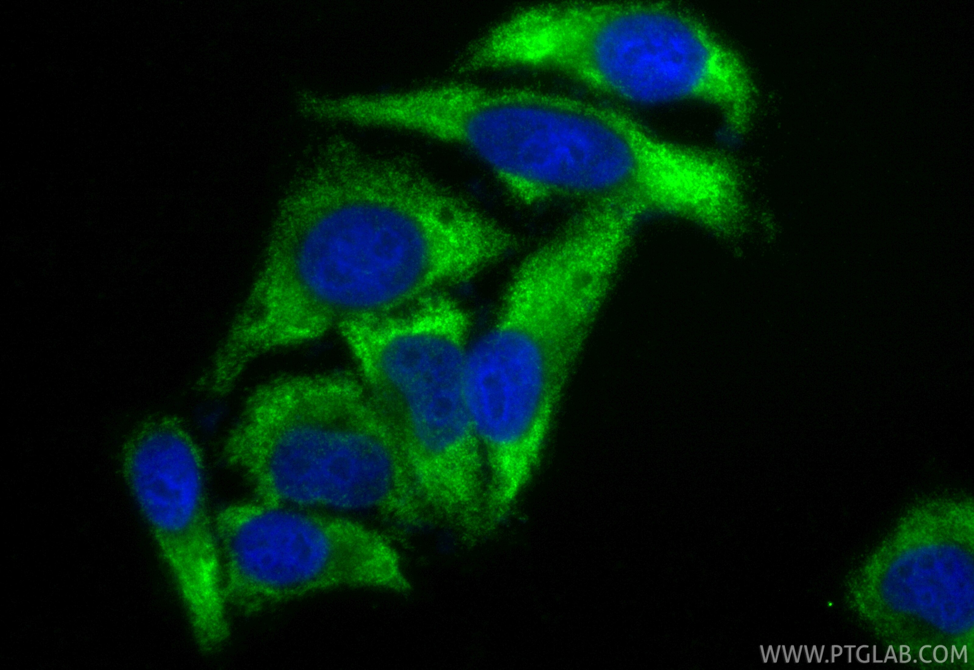 Immunofluorescent analysis of (-20°C Ethanol) fixed HepG2 cells using CoraLite® Plus 488 Alpha-2-Macroglobulin antibody (CL488-84347-5, Clone: 241649D2 ) at dilution of 1:200. Immunofluorescence (IF) / fluorescent staining of HepG2 cells using CoraLite® Plus 488-conjugated Alpha-2-Macroglobuli (CL488-84347-5)