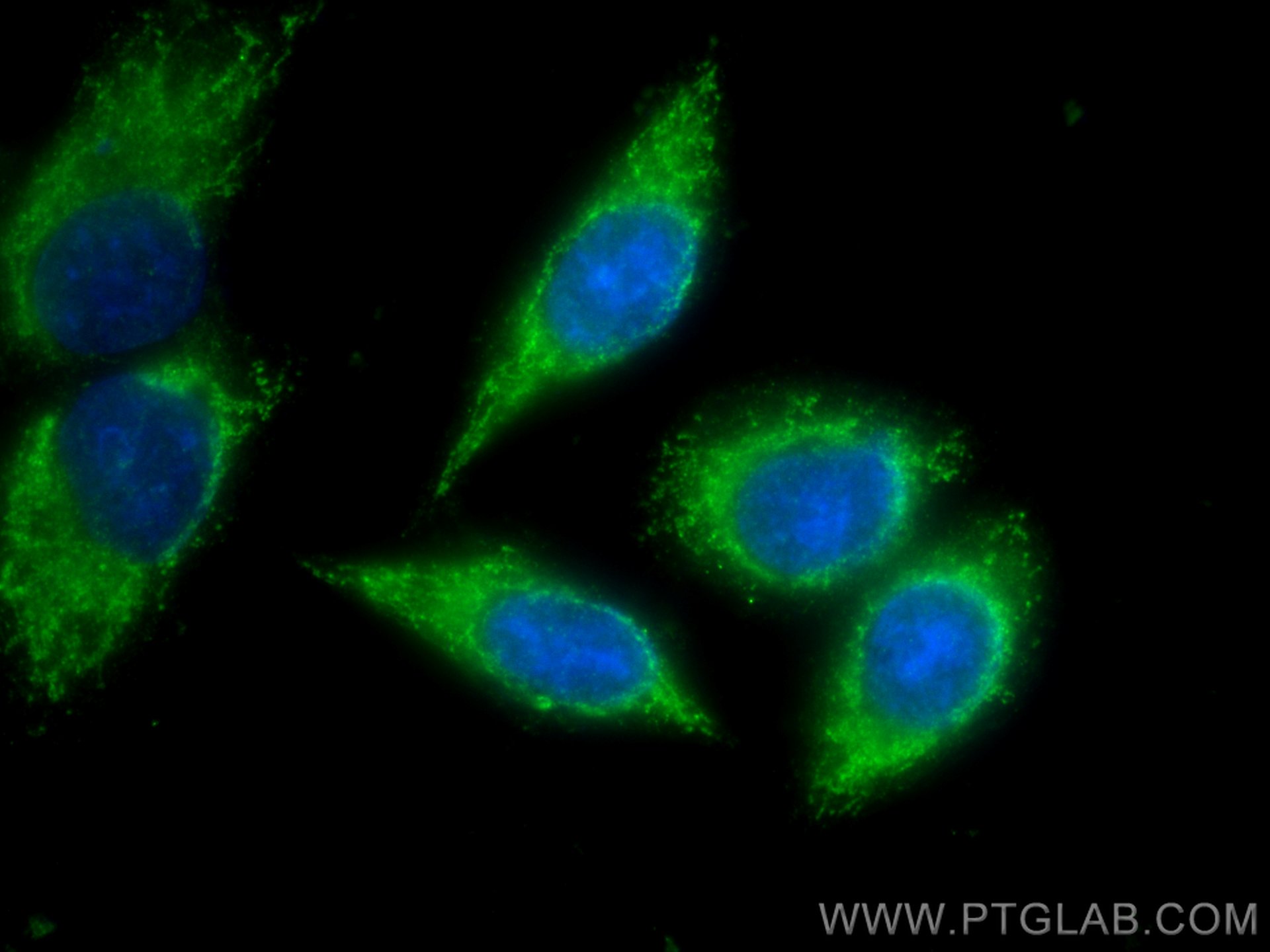 Immunofluorescence (IF) / fluorescent staining of HepG2 cells using Alpha-2-antiplasmin Polyclonal antibody (28549-1-AP)