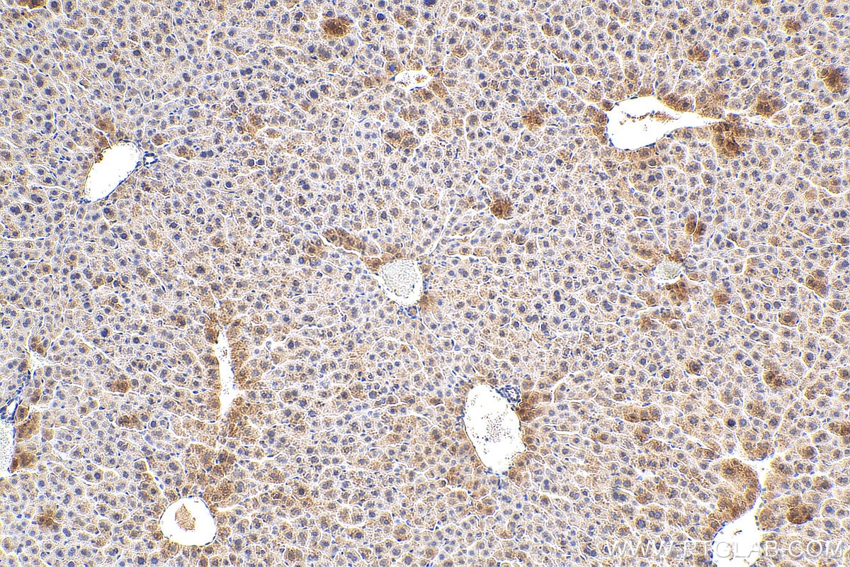 Immunohistochemistry (IHC) staining of mouse liver tissue using Alpha-2-antiplasmin Polyclonal antibody (28549-1-AP)