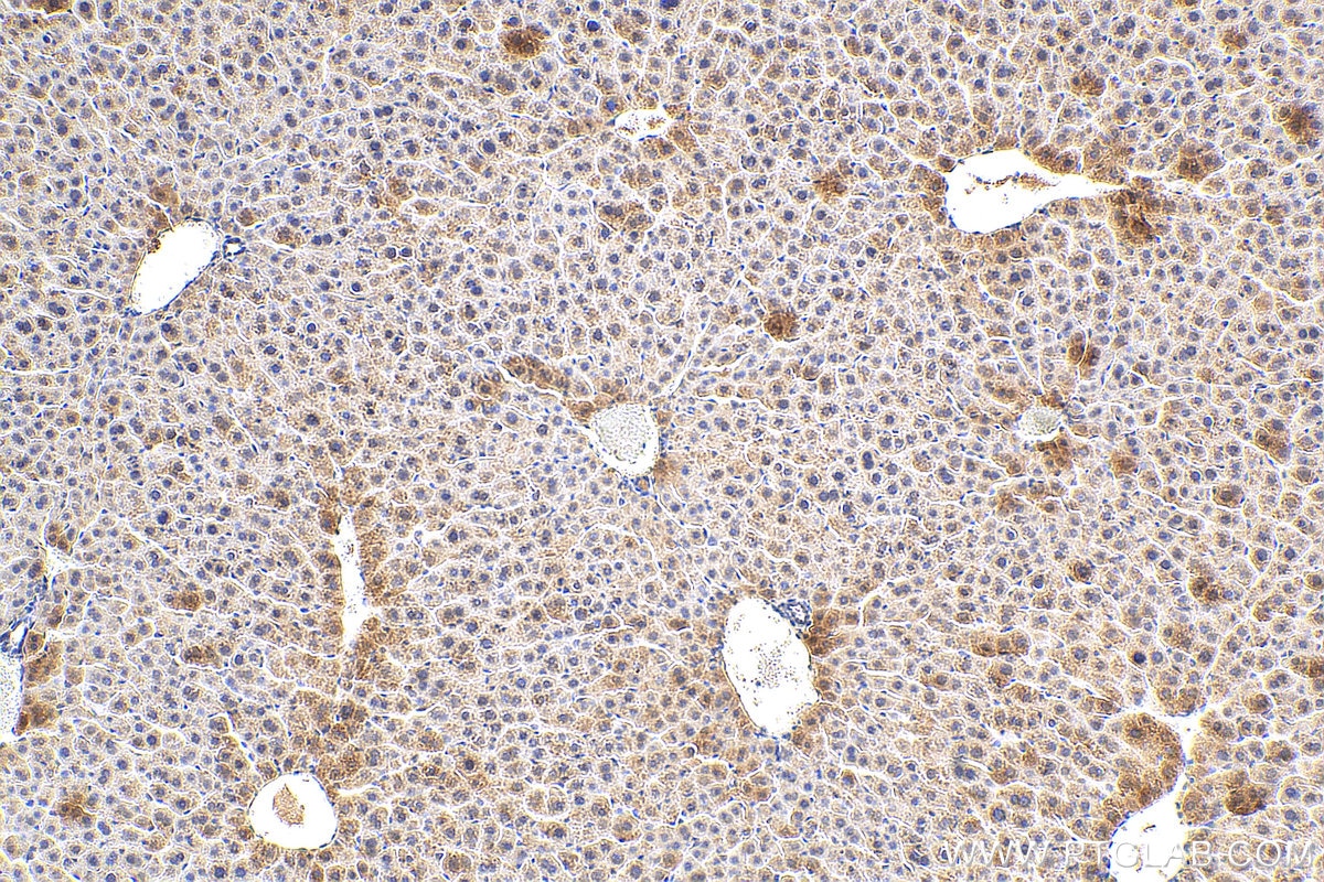 Alpha-2-antiplasmin