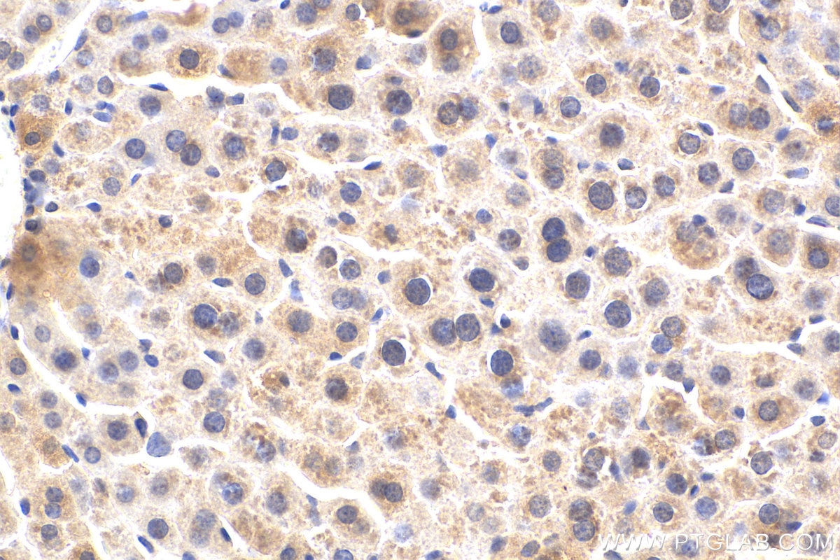 Immunohistochemistry (IHC) staining of mouse liver tissue using Alpha-2-antiplasmin Polyclonal antibody (28549-1-AP)