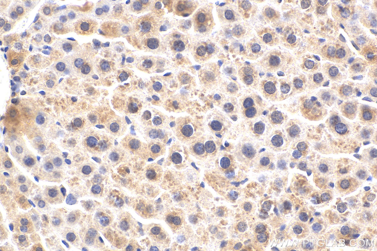 Immunohistochemistry (IHC) staining of mouse liver tissue using Alpha-2-antiplasmin Polyclonal antibody (28549-1-AP)