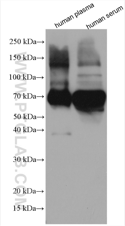 Western Blot (WB) analysis of human plasma using Alpha-2-antiplasmin Polyclonal antibody (28549-1-AP)