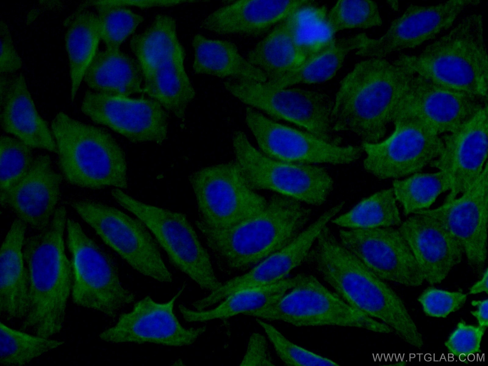 Immunofluorescence (IF) / fluorescent staining of HepG2 cells using Alpha 2-Antiplasmin Monoclonal antibody (67308-1-Ig)