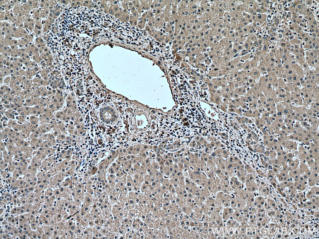 Immunohistochemistry (IHC) staining of human liver tissue using Alpha 2-Antiplasmin Monoclonal antibody (67308-1-Ig)