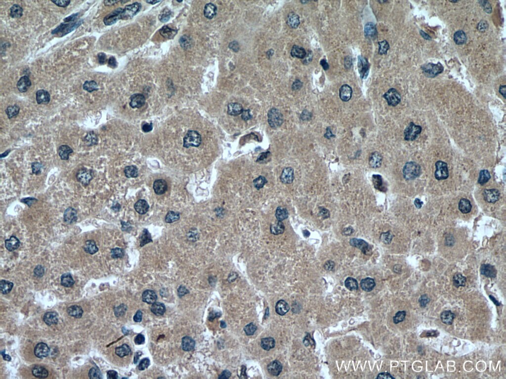 Immunohistochemistry (IHC) staining of human liver tissue using Alpha 2-Antiplasmin Monoclonal antibody (67308-1-Ig)