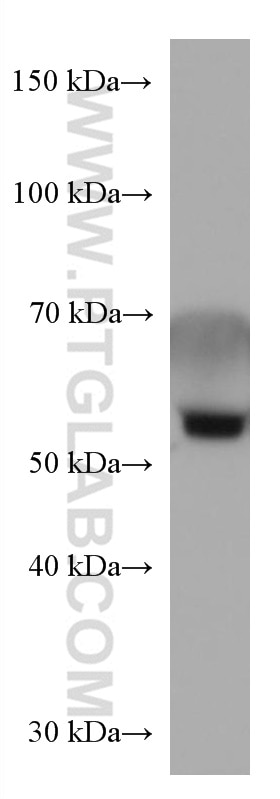 Western Blot (WB) analysis of human plasma using Alpha 2-Antiplasmin Monoclonal antibody (67308-1-Ig)