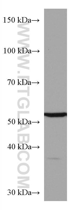 Western Blot (WB) analysis of HuH-7 cells using Alpha 2-Antiplasmin Monoclonal antibody (67308-1-Ig)