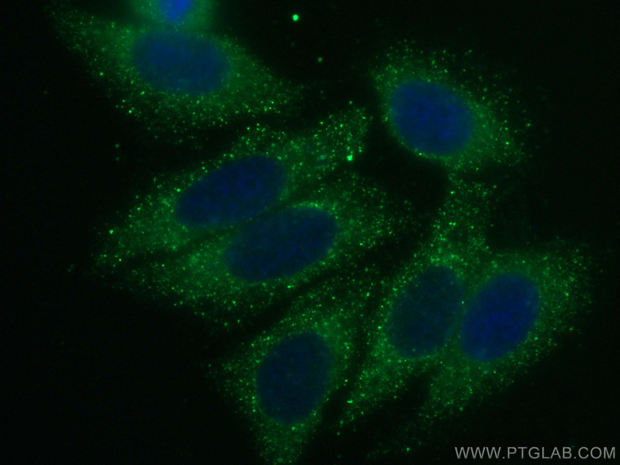 Immunofluorescence (IF) / fluorescent staining of HepG2 cells using CoraLite® Plus 488-conjugated Alpha-2-Macroglobuli (CL488-66126)