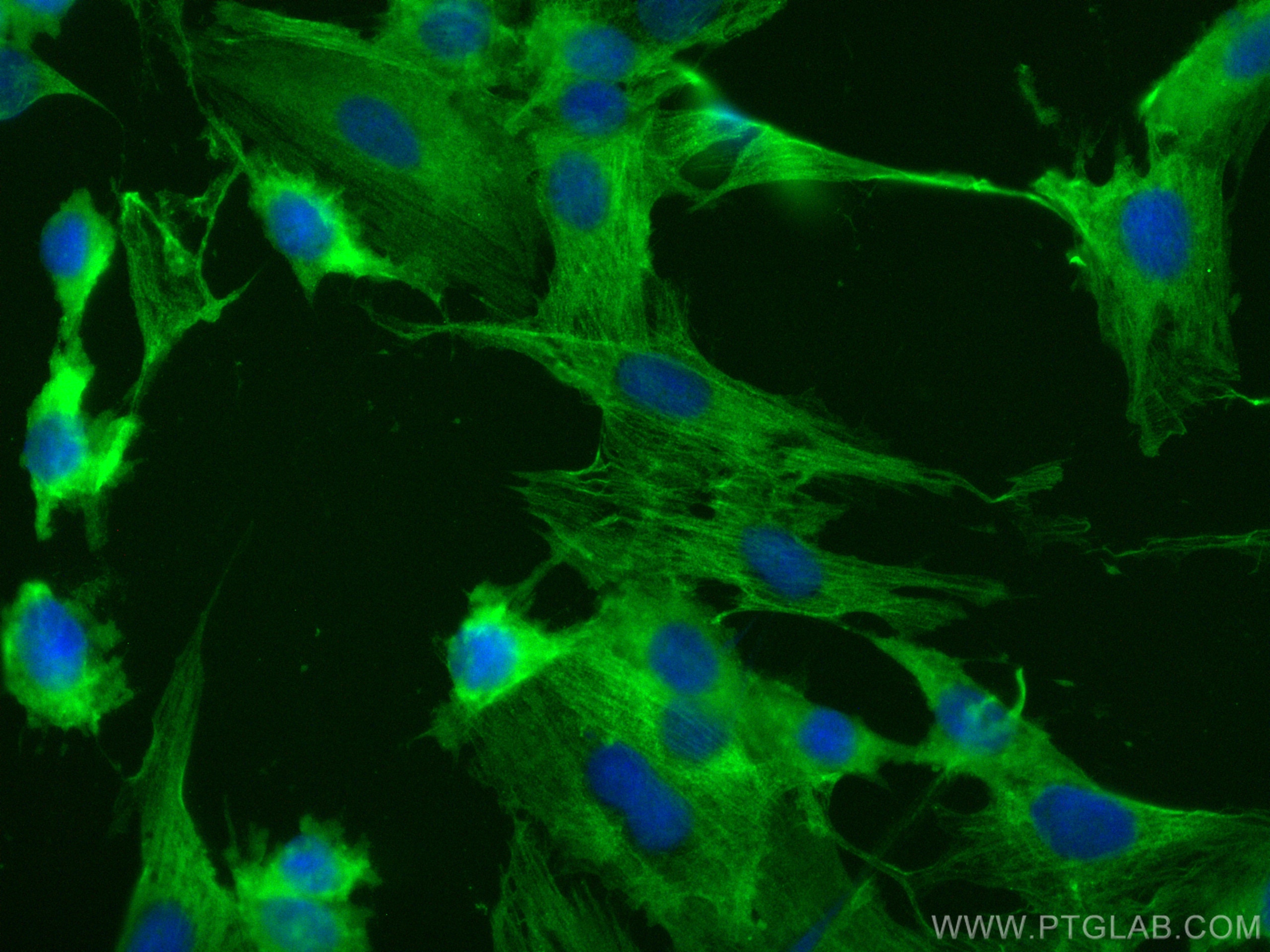 Immunofluorescence (IF) / fluorescent staining of H9C2 cells using CoraLite® Plus 488-conjugated Alpha Actin Polyclon (CL488-23660)