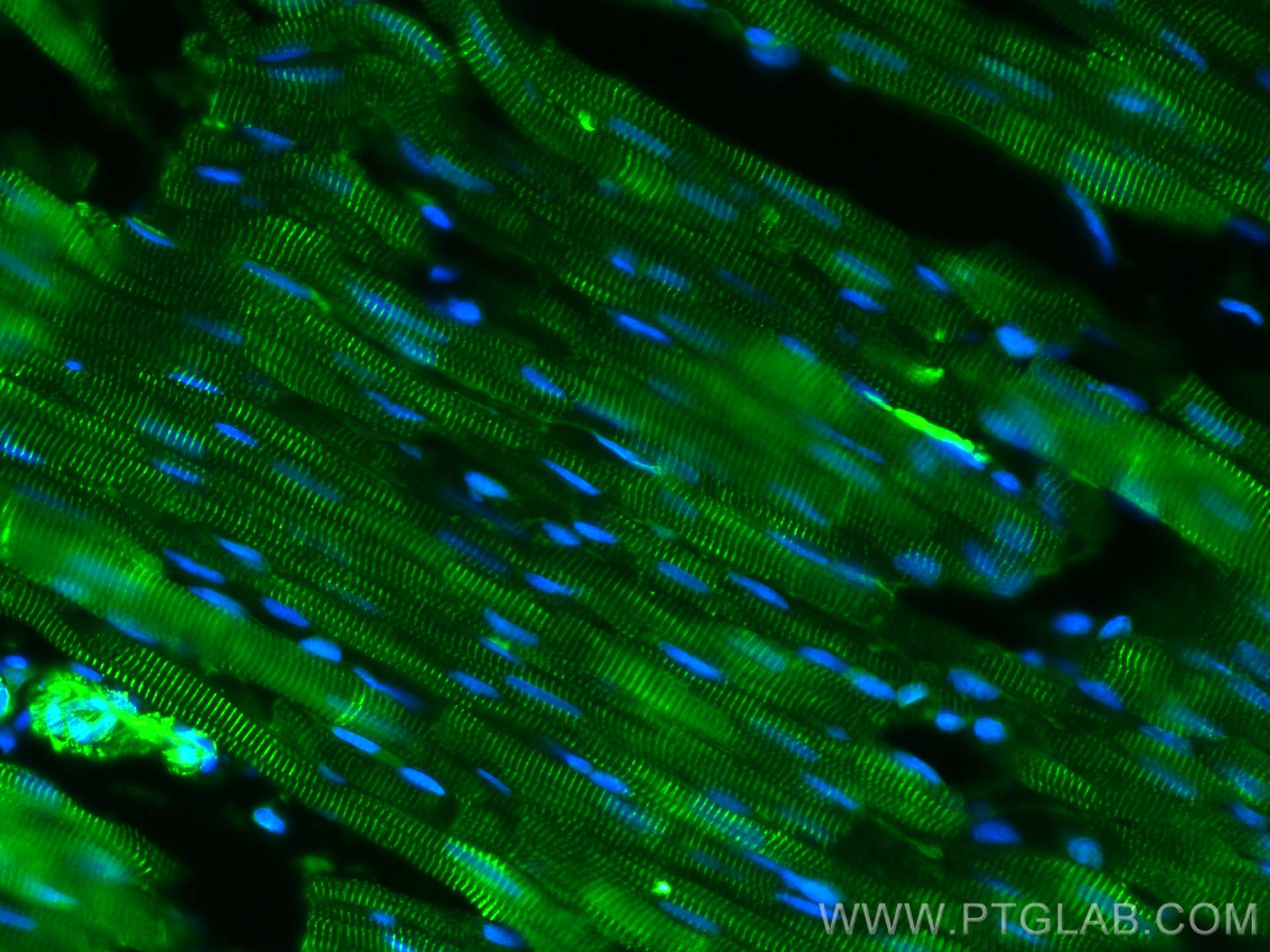 Immunofluorescence (IF) / fluorescent staining of rat heart tissue using CoraLite® Plus 488-conjugated Alpha Actinin Polycl (CL488-11313)