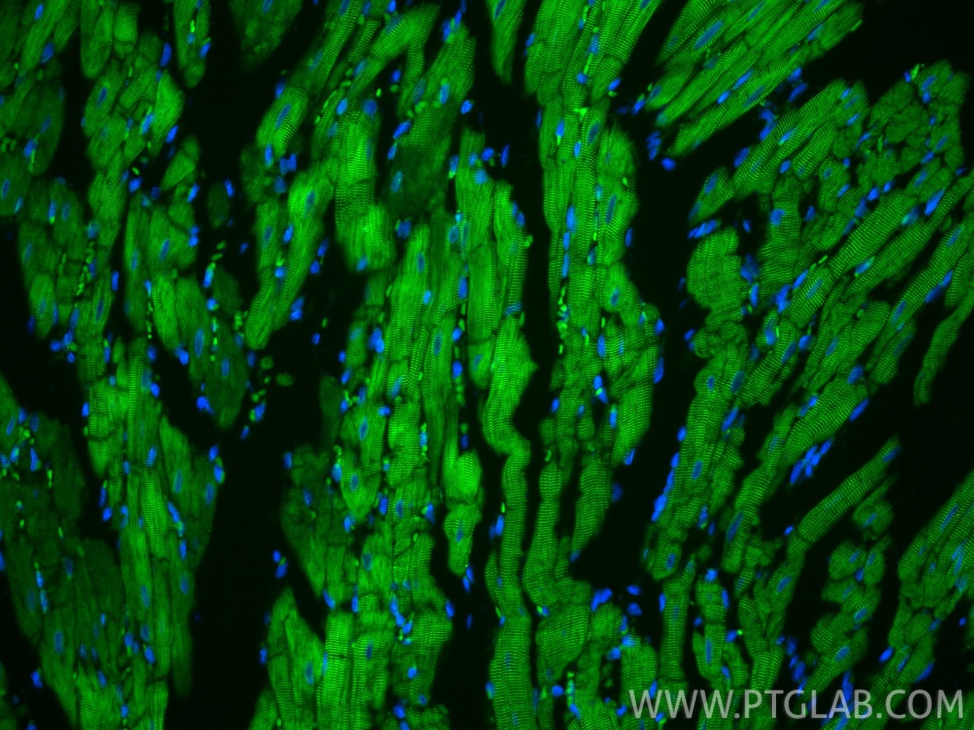IF Staining of rat heart using CL488-86340-2 Immunofluorescence (IF) / fluorescent staining of rat heart tissue using CoraLite® Plus 488-conjugated Alpha Actinin Recomb (CL488-86340-2)