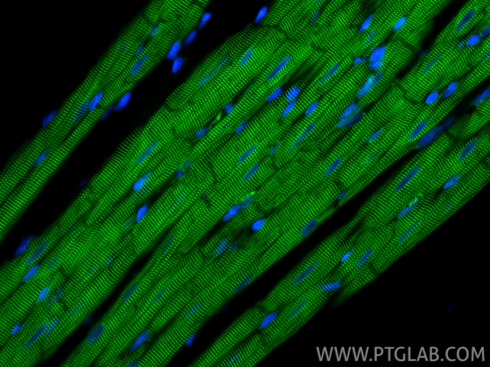 IF Staining of rat heart using CL488-86340-2 Immunofluorescence (IF) / fluorescent staining of rat heart tissue using CoraLite® Plus 488-conjugated Alpha Actinin Recomb (CL488-86340-2)