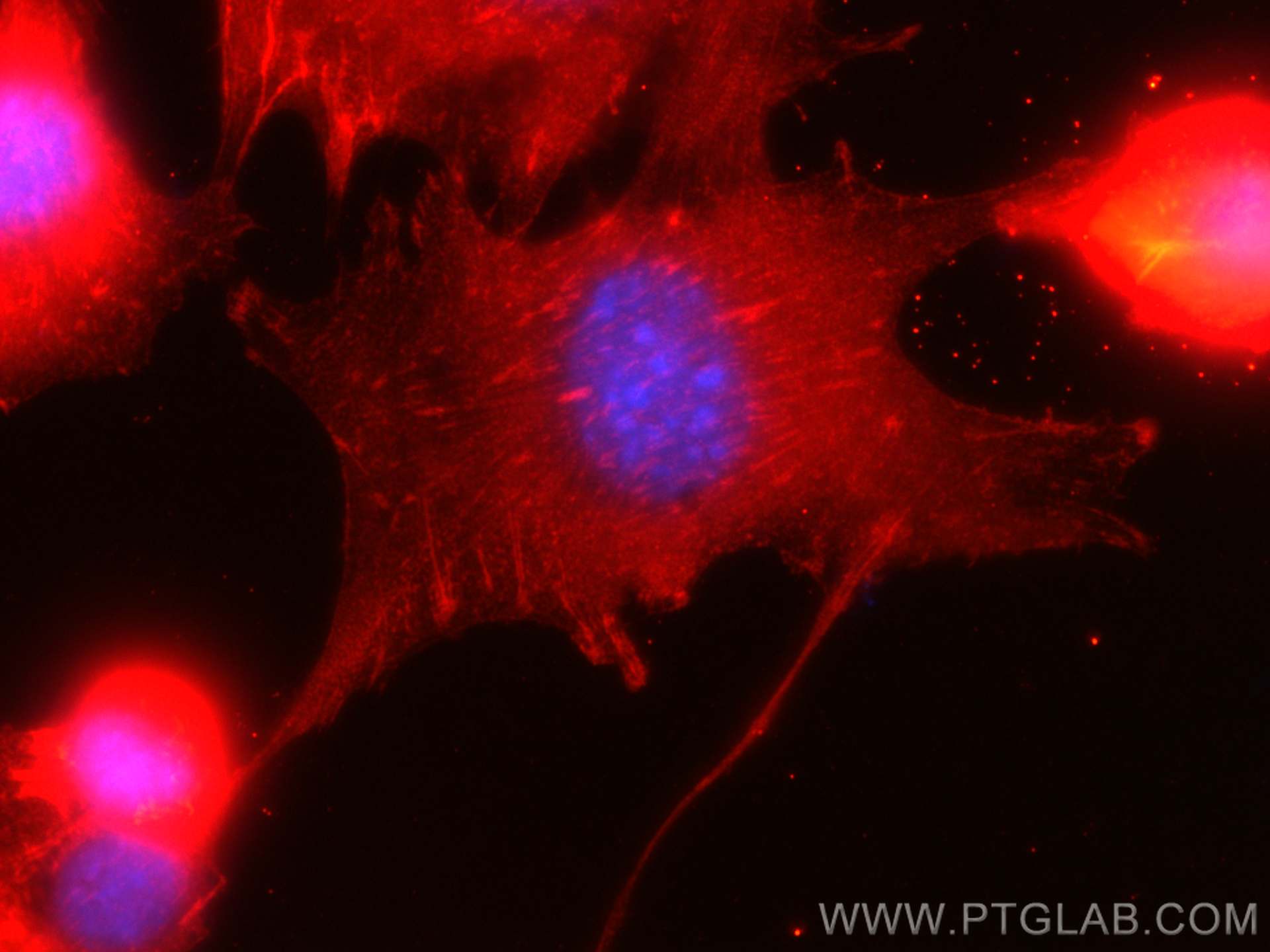 Immunofluorescence (IF) / fluorescent staining of C2C12 cells using CoraLite®594-conjugated Alpha Actinin Monoclonal a (CL594-66895)