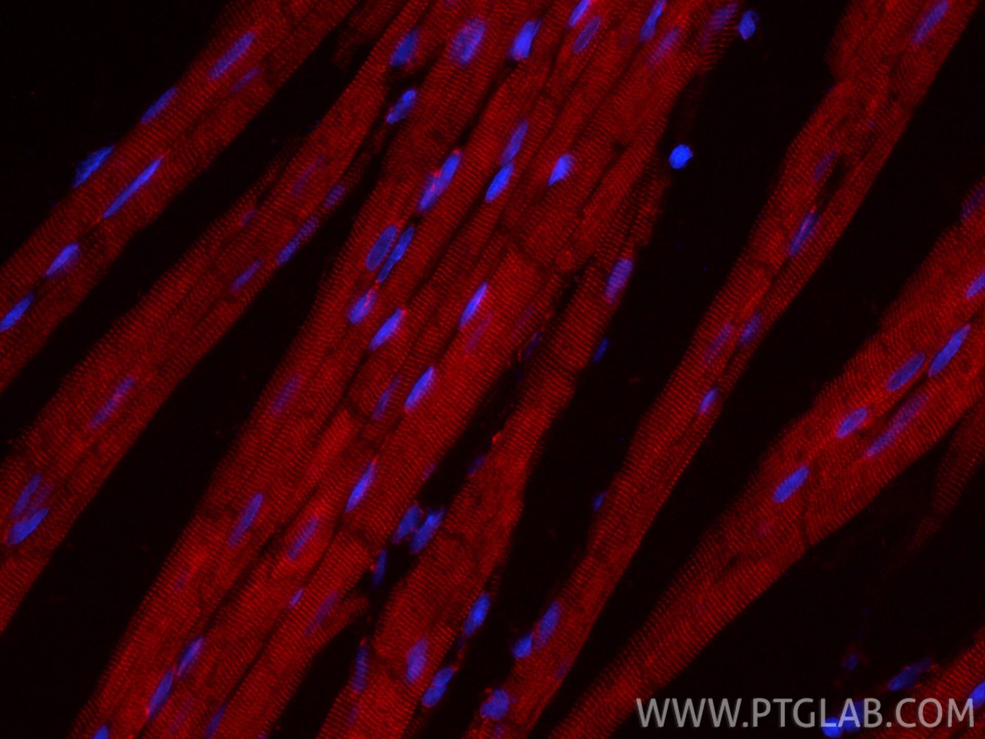 Immunofluorescence (IF) / fluorescent staining of rat heart tissue using CoraLite®594-conjugated Alpha Actinin Recombinant  (CL594-86340-2)