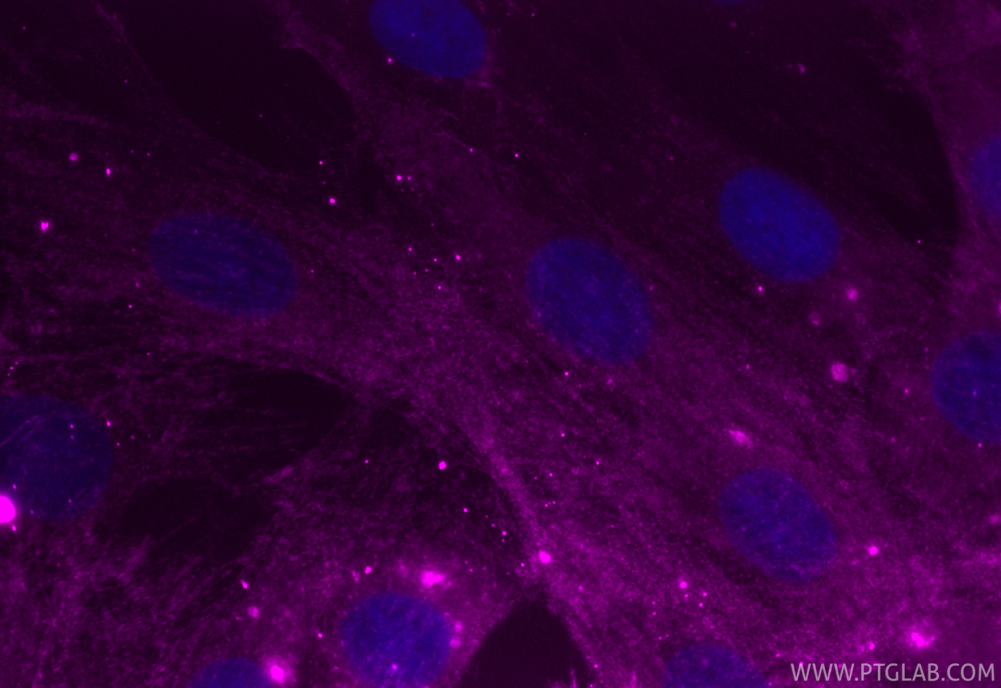 Immunofluorescence (IF) / fluorescent staining of H9C2 cells using CoraLite® Plus 647-conjugated Alpha Actinin Monocl (CL647-66895)