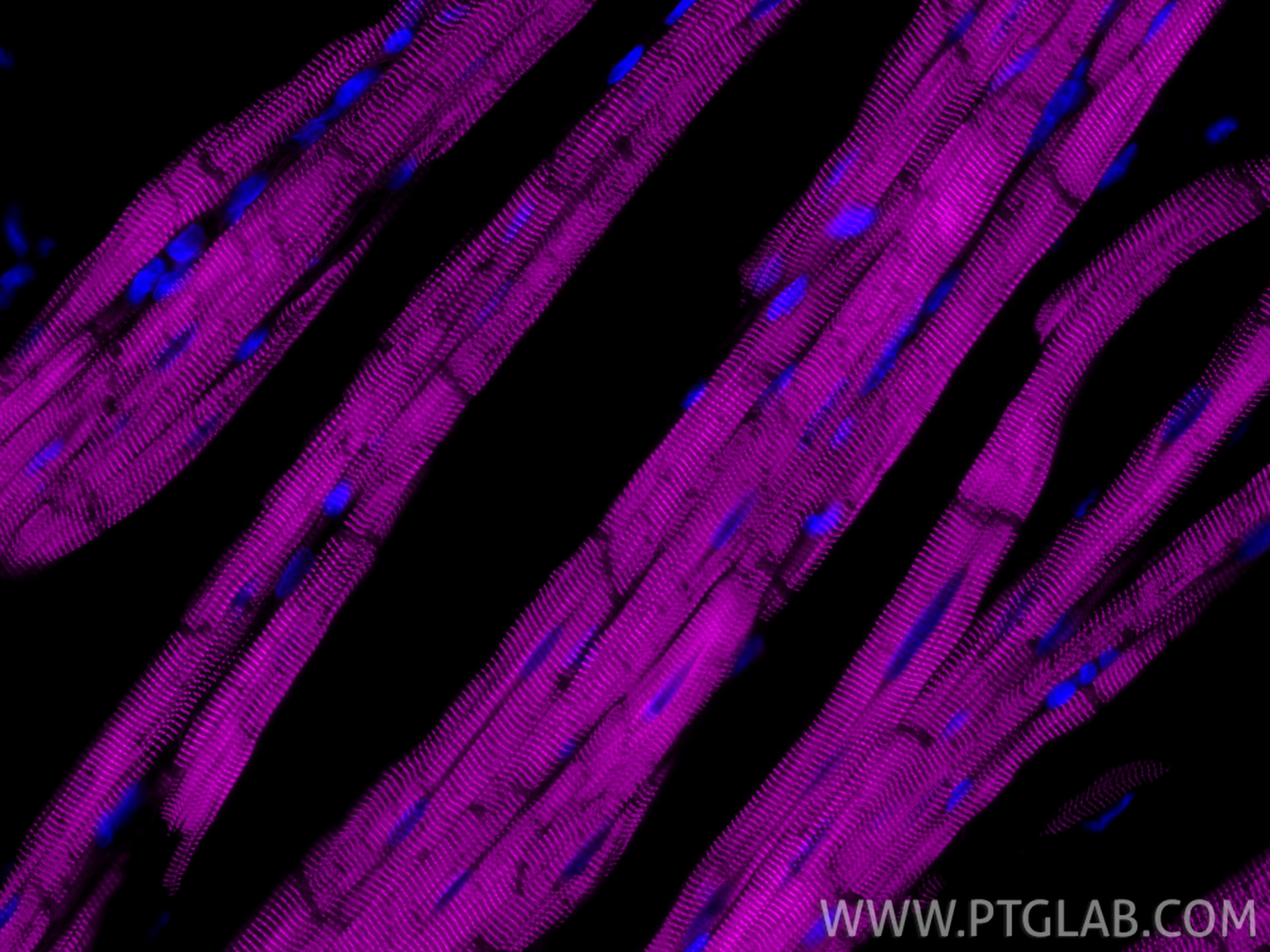 Immunofluorescence (IF) / fluorescent staining of rat heart tissue using CoraLite® Plus 647-conjugated Alpha Actinin Recomb (CL647-86340-2)