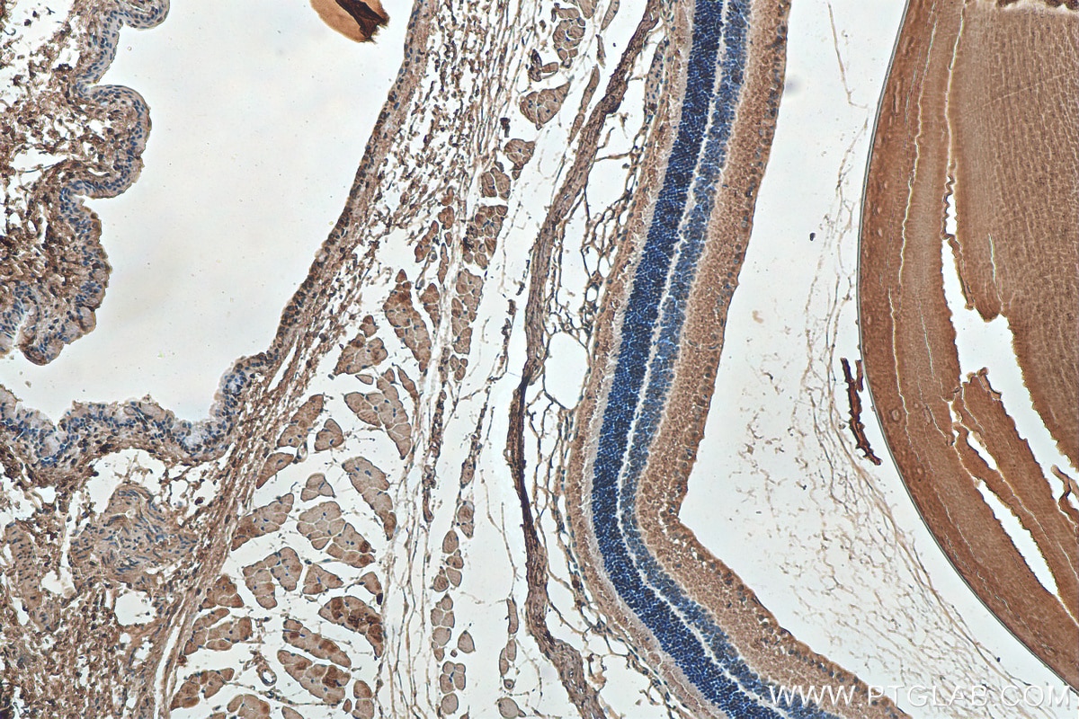 Immunohistochemistry (IHC) staining of mouse eye tissue using Alpha B Crystallin Monoclonal antibody (68001-1-Ig)