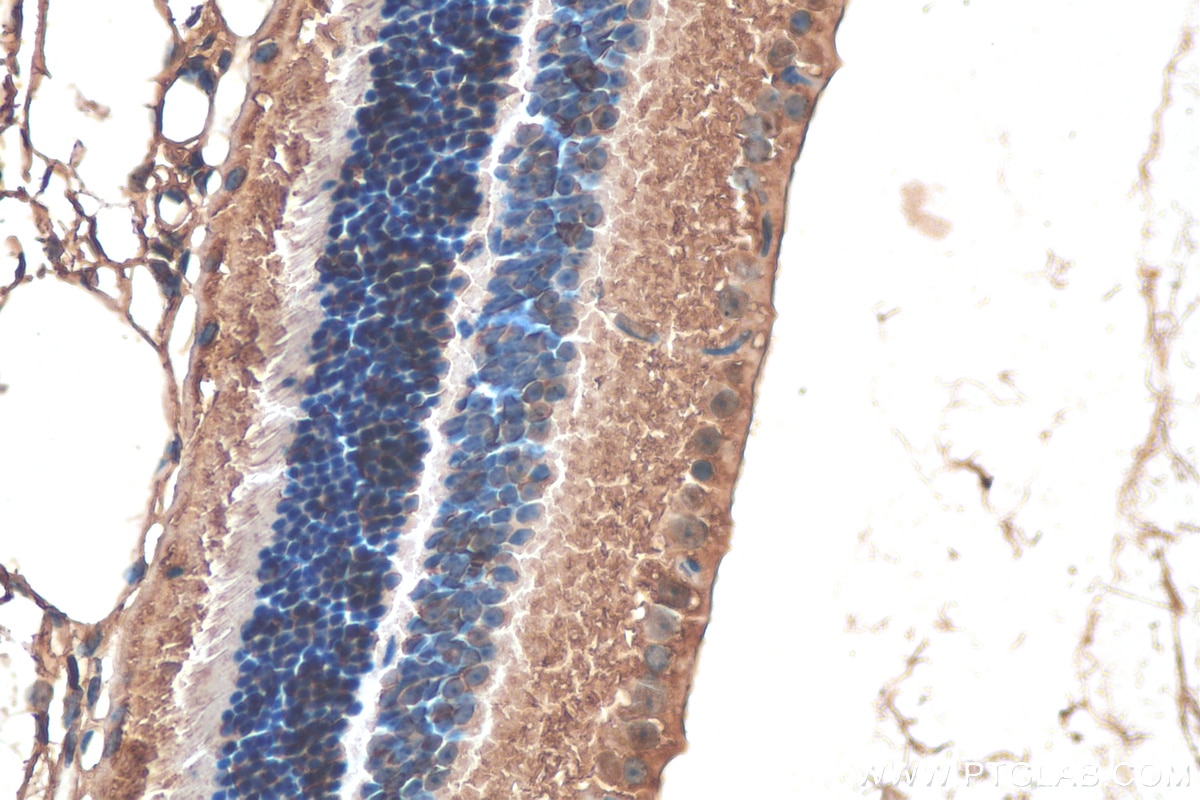 Immunohistochemistry (IHC) staining of mouse eye tissue using Alpha B Crystallin Monoclonal antibody (68001-1-Ig)