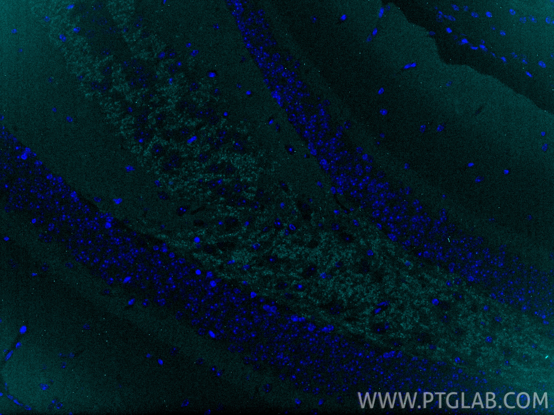 IF Staining of mouse brain using CL750-10842 Immunofluorescence (IF) / fluorescent staining of mouse brain tissue using CoraLite® Plus 750-conjugated Alpha Synuclein Poly (CL750-10842)