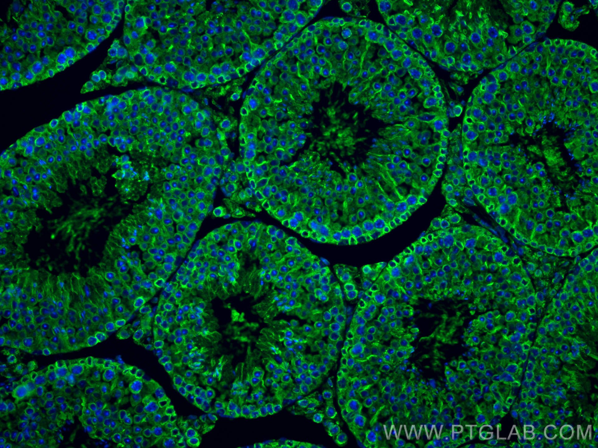 Immunofluorescence (IF) / fluorescent staining of mouse testis tissue using Alpha Tubulin Recombinant antibody (80762-1-RR)