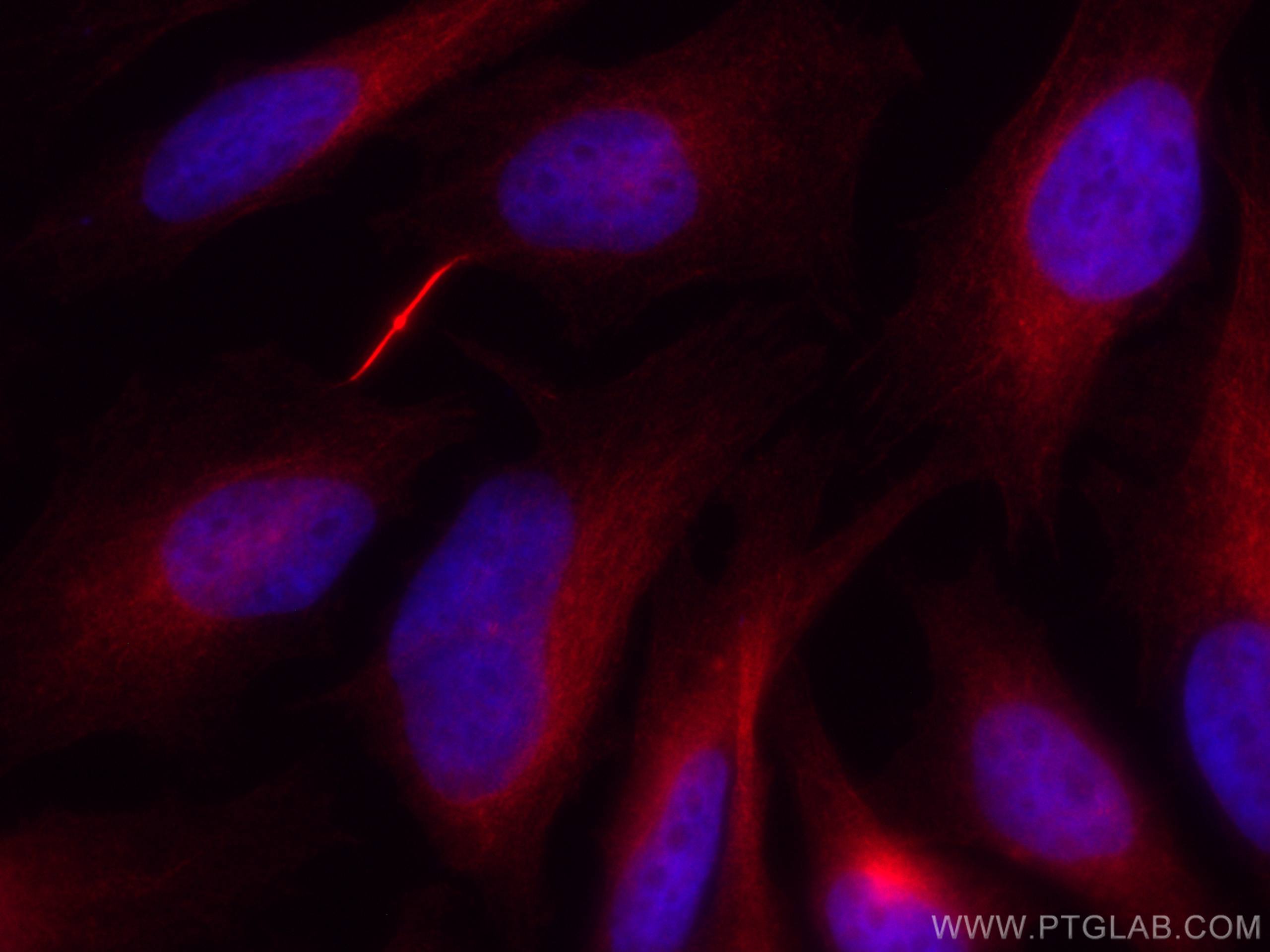 Immunofluorescence (IF) / fluorescent staining of HeLa cells using CoraLite®555-conjugated Alpha Tubulin Monoclonal a (CL555-66031)