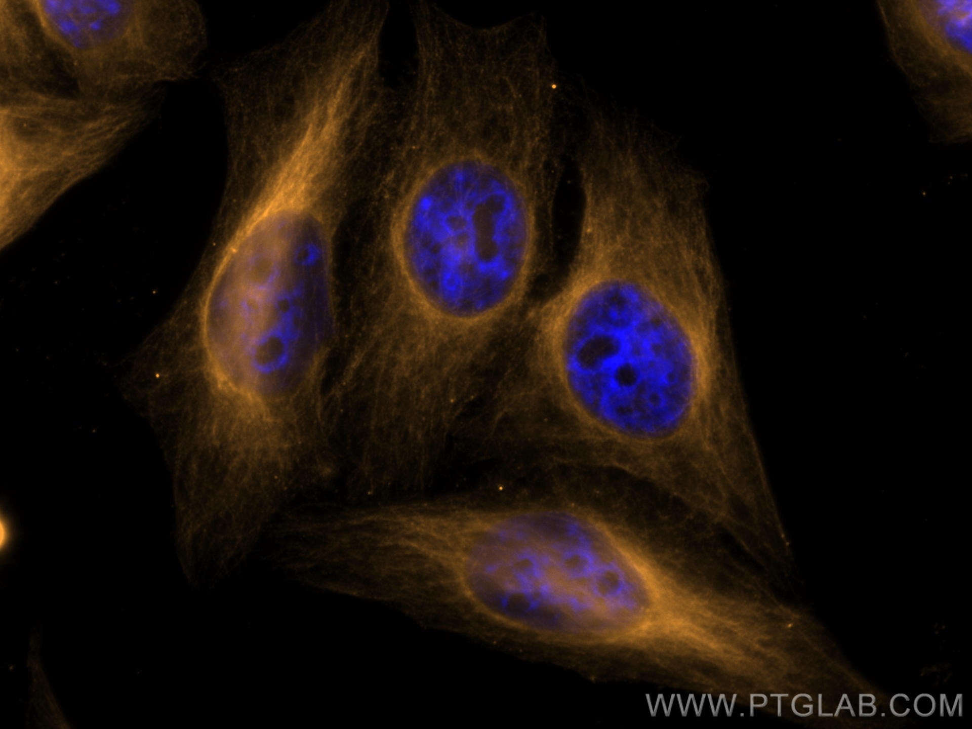 Immunofluorescence (IF) / fluorescent staining of HepG2 cells using CoraLite®555-conjugated Alpha Tubulin Monoclonal a (CL555-66031)