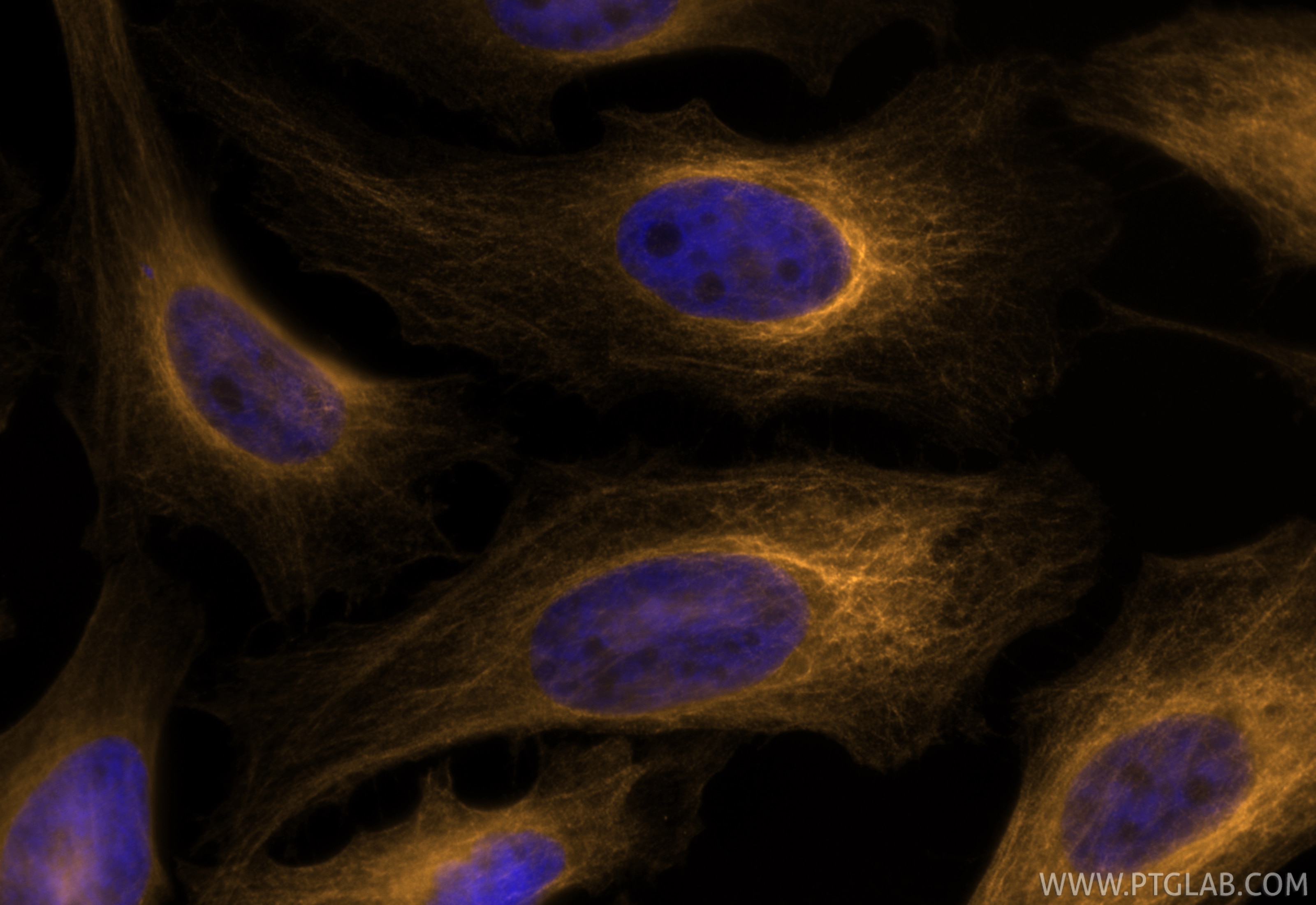 Immunofluorescence (IF) / fluorescent staining of HeLa cells using CoraLite® Plus 555-conjugated Alpha Tubulin Recomb (CL555-80762)
