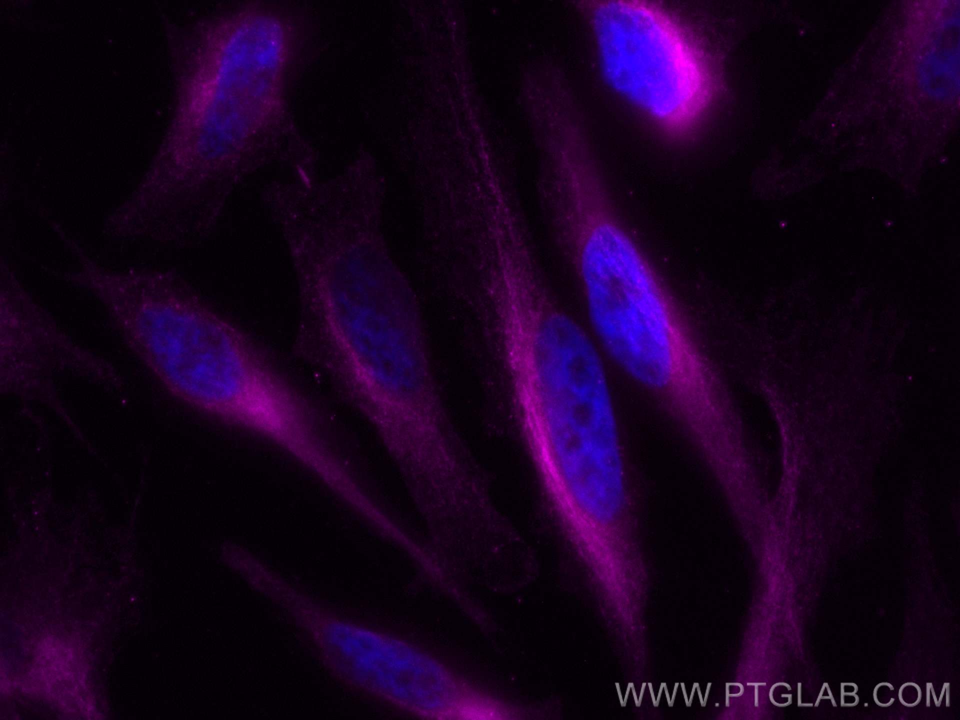 Immunofluorescence (IF) / fluorescent staining of HeLa cells using CoraLite® Plus 647-conjugated Alpha Tubulin Monocl (CL647-66031)