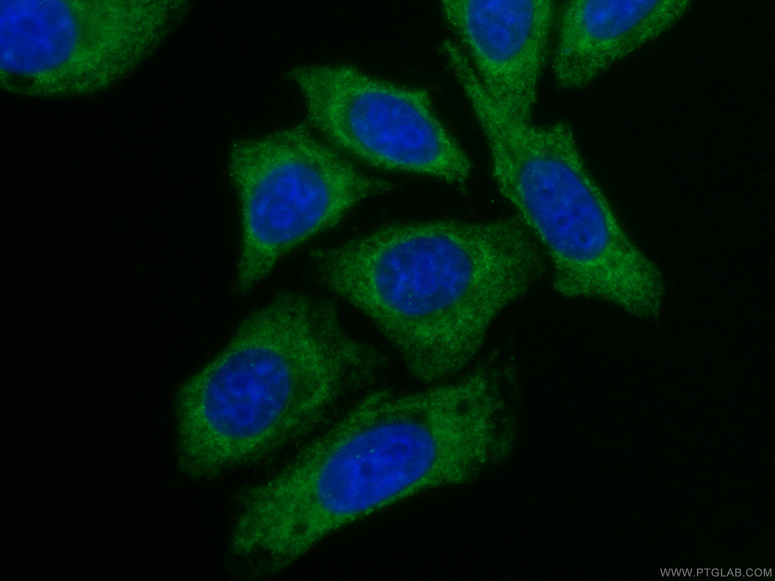 Immunofluorescence (IF) / fluorescent staining of HepG2 cells using CoraLite® Plus 488-conjugated Alpha Galactosidase  (CL488-66121)