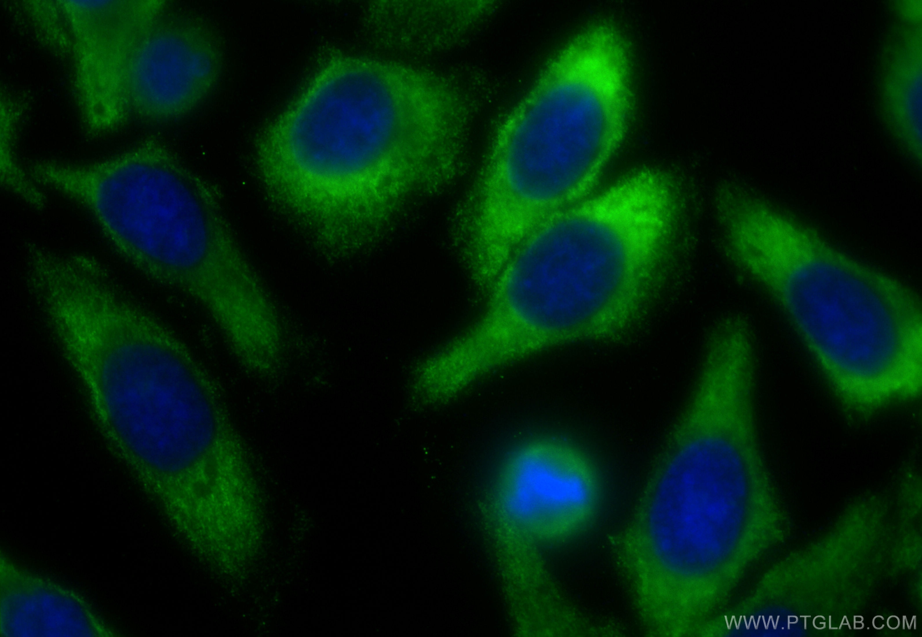 Immunofluorescence (IF) / fluorescent staining of HepG2 cells using CoraLite® Plus 488-conjugated Alpha Galactosidase  (CL488-66121)