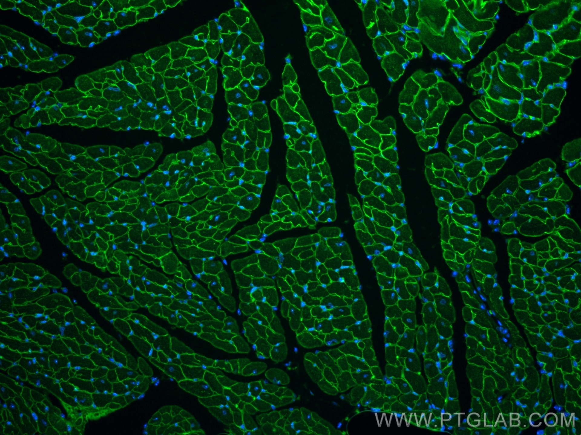 Immunofluorescence (IF) / fluorescent staining of mouse heart tissue using Alpha Sarcoglycan Monoclonal antibody (67078-1-Ig)