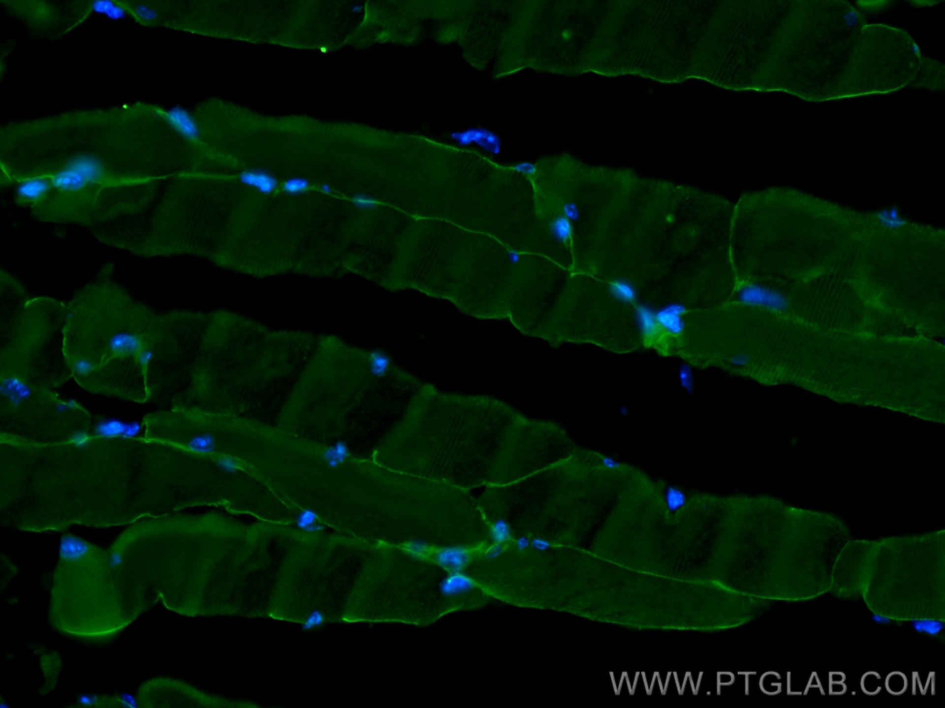 Immunofluorescence (IF) / fluorescent staining of mouse skeletal muscle tissue using Alpha Sarcoglycan Monoclonal antibody (67078-1-Ig)