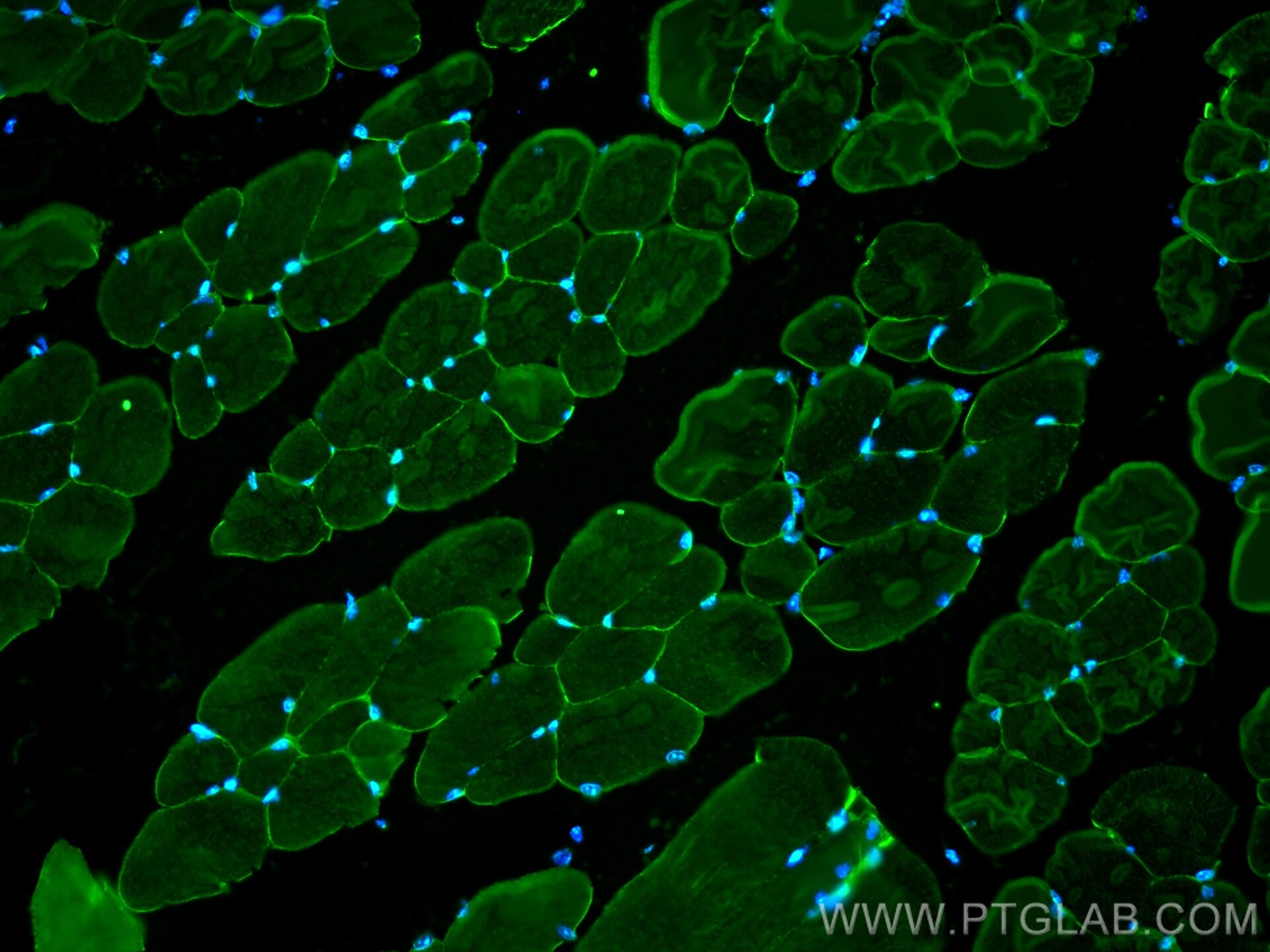 Immunofluorescence (IF) / fluorescent staining of mouse skeletal muscle tissue using Alpha Sarcoglycan Monoclonal antibody (67078-1-Ig)