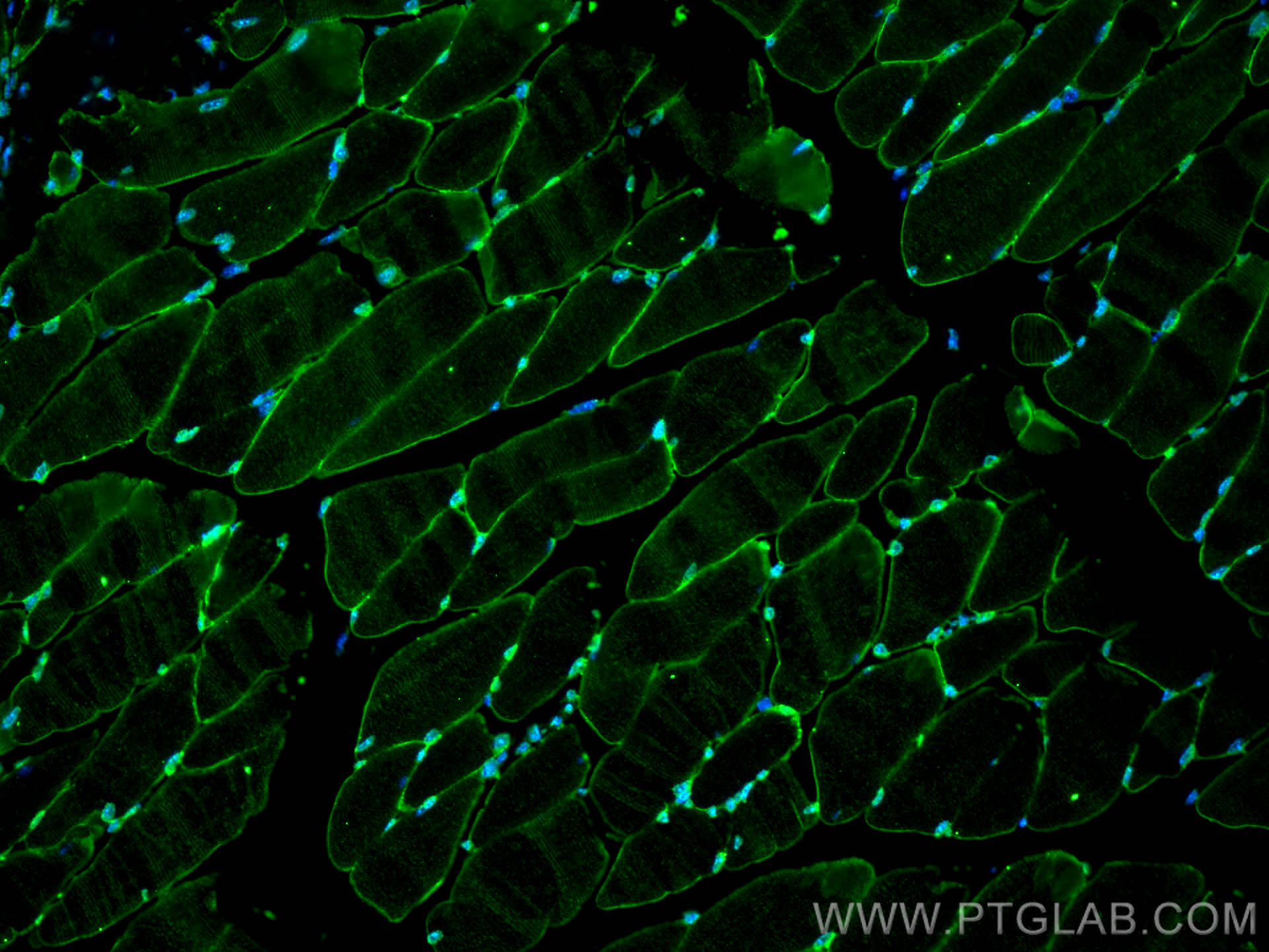 Immunofluorescence (IF) / fluorescent staining of mouse skeletal muscle tissue using Alpha Sarcoglycan Monoclonal antibody (67078-1-Ig)