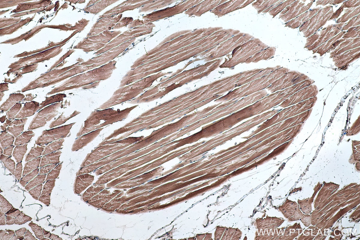 Immunohistochemistry (IHC) staining of mouse skeletal muscle tissue using Alpha Sarcoglycan Monoclonal antibody (67078-1-Ig)