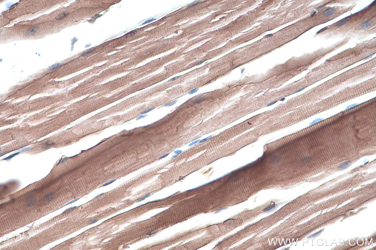 Immunohistochemistry (IHC) staining of mouse skeletal muscle tissue using Alpha Sarcoglycan Monoclonal antibody (67078-1-Ig)